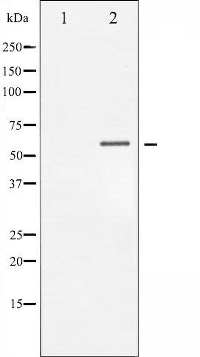 Phospho-Chk1 (Ser317) Antibody in Western Blot (WB)