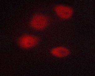 Phospho-HDAC3 (Ser424) Antibody in Immunocytochemistry (ICC/IF)