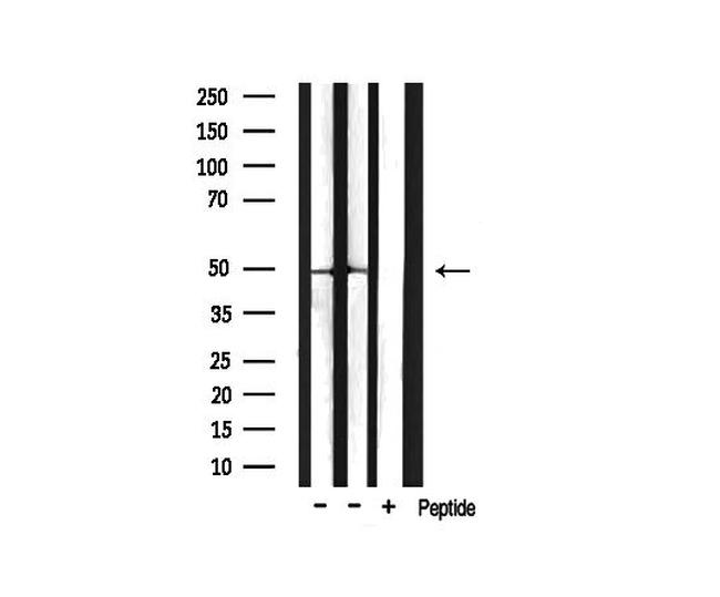 Phospho-HDAC3 (Ser424) Antibody in Western Blot (WB)