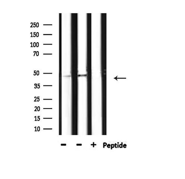 Phospho-HDAC3 (Ser424) Antibody in Western Blot (WB)