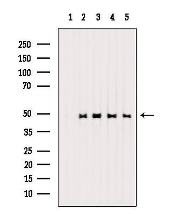 Phospho-HDAC3 (Ser424) Antibody in Western Blot (WB)