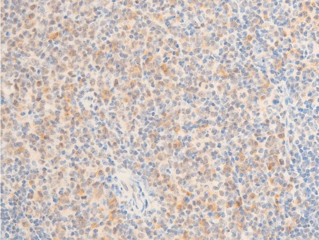 Phospho-TAK1 (Thr187) Antibody in Immunohistochemistry (Paraffin) (IHC (P))