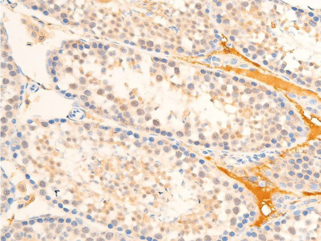 Phospho-TAK1 (Thr187) Antibody in Immunohistochemistry (Paraffin) (IHC (P))