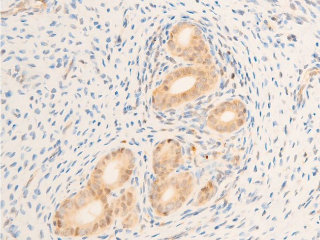 Phospho-TAK1 (Thr187) Antibody in Immunohistochemistry (Paraffin) (IHC (P))