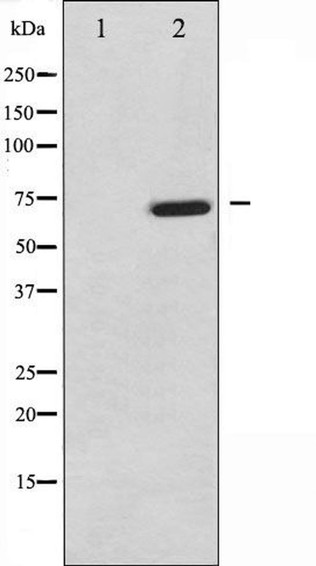 Phospho-TAK1 (Thr187) Antibody in Western Blot (WB)