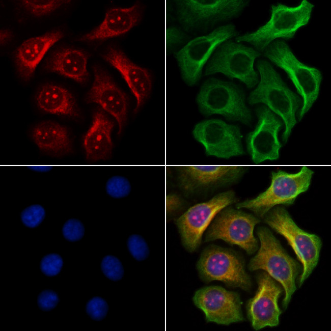 Phospho-JAK2 (Tyr1007) Antibody in Immunocytochemistry (ICC/IF)