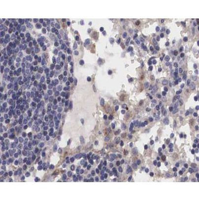 Phospho-JAK2 (Tyr1007) Antibody in Immunohistochemistry (Paraffin) (IHC (P))