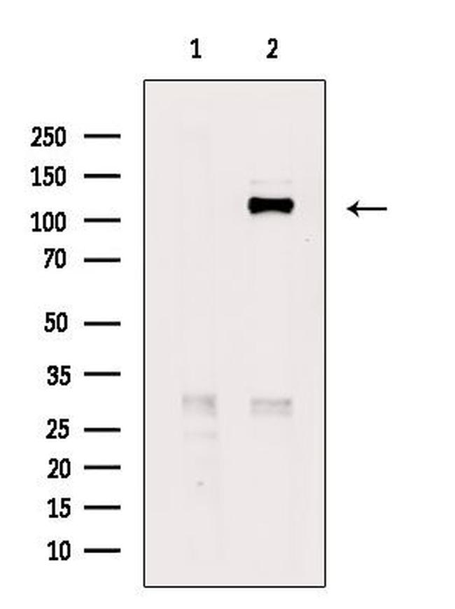 Phospho-JAK2 (Tyr1007) Antibody in Western Blot (WB)