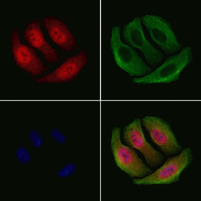 Phospho-Chk2 (Ser516) Antibody in Immunocytochemistry (ICC/IF)