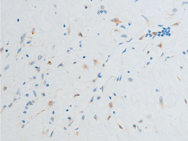 Phospho-Chk2 (Ser516) Antibody in Immunohistochemistry (Paraffin) (IHC (P))