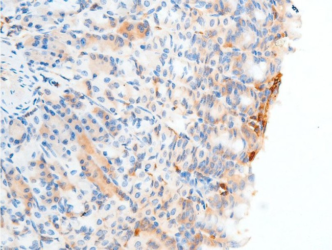 Phospho-Chk2 (Ser516) Antibody in Immunohistochemistry (Paraffin) (IHC (P))