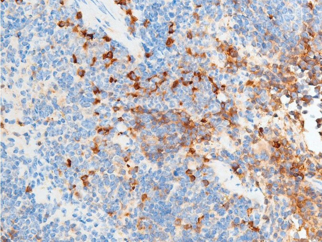 Phospho-Chk2 (Ser516) Antibody in Immunohistochemistry (Paraffin) (IHC (P))