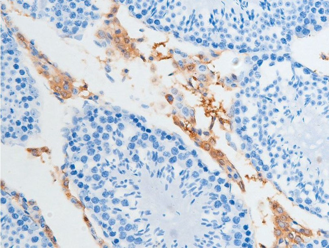 Phospho-Chk2 (Ser516) Antibody in Immunohistochemistry (Paraffin) (IHC (P))