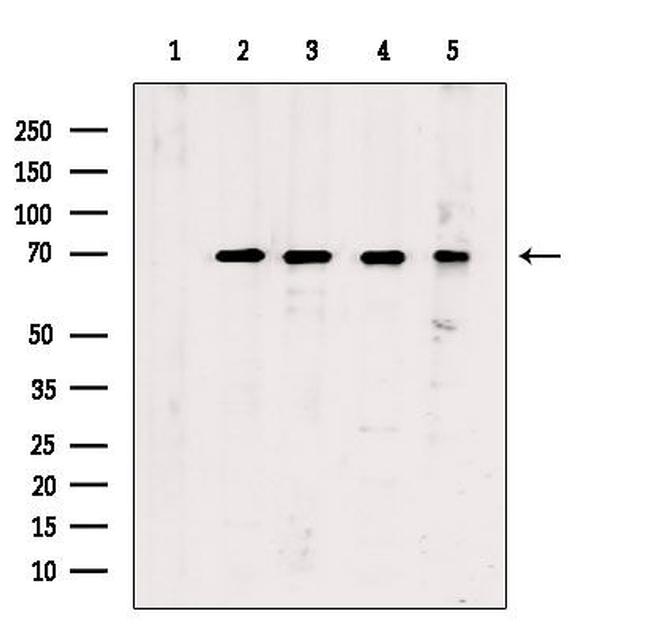 Phospho-Chk2 (Ser516) Antibody in Western Blot (WB)