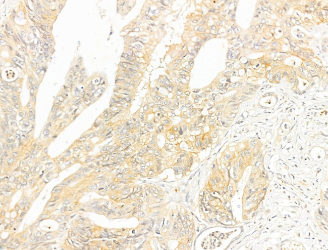 Phospho-LCK (Tyr505) Antibody in Immunohistochemistry (Paraffin) (IHC (P))