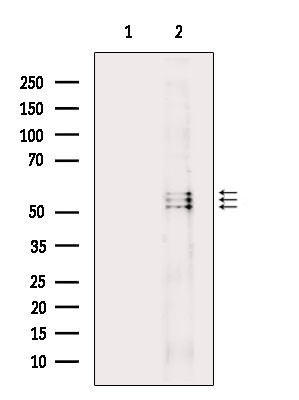 Phospho-Lyn (Tyr508) Antibody in Western Blot (WB)