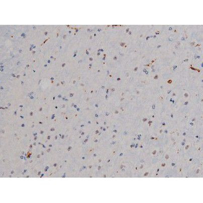 Phospho-Lyn (Tyr508) Antibody in Immunohistochemistry (Paraffin) (IHC (P))