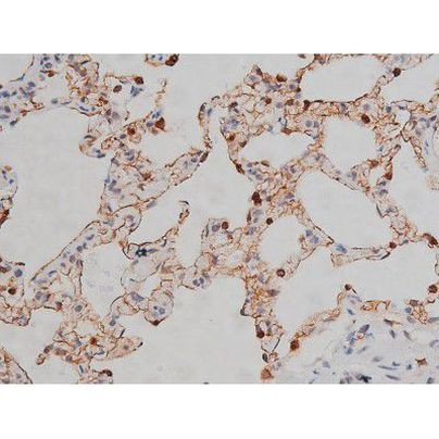 Phospho-Lyn (Tyr508) Antibody in Immunohistochemistry (Paraffin) (IHC (P))