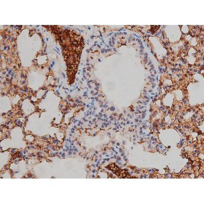 Phospho-Lyn (Tyr508) Antibody in Immunohistochemistry (Paraffin) (IHC (P))