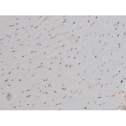 Phospho-Lyn (Tyr508) Antibody in Immunohistochemistry (Paraffin) (IHC (P))