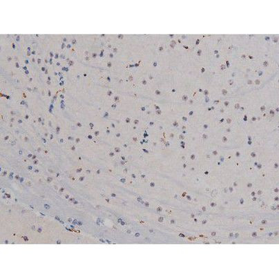 Phospho-Lyn (Tyr508) Antibody in Immunohistochemistry (Paraffin) (IHC (P))