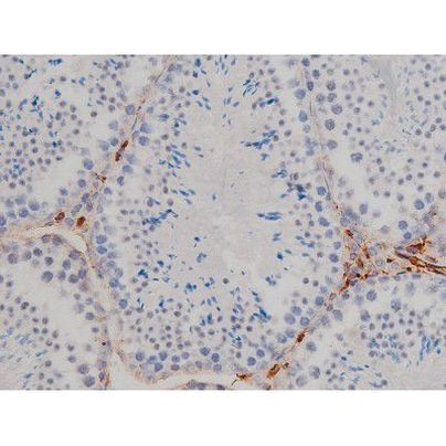 Phospho-Lyn (Tyr508) Antibody in Immunohistochemistry (Paraffin) (IHC (P))