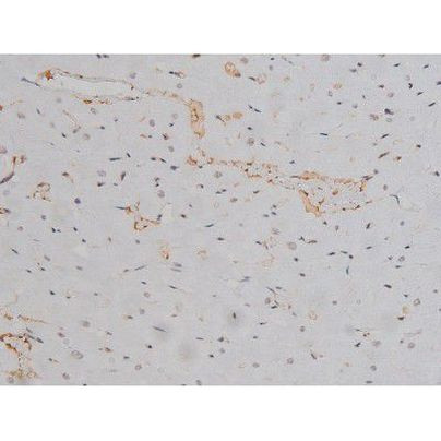 Phospho-Lyn (Tyr508) Antibody in Immunohistochemistry (Paraffin) (IHC (P))