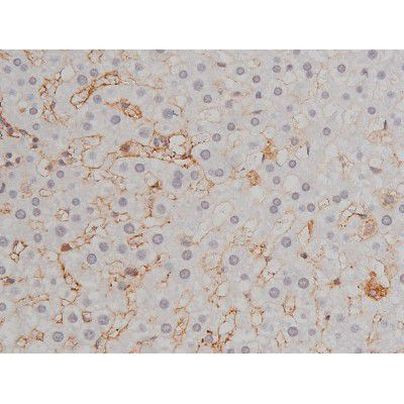 Phospho-Lyn (Tyr508) Antibody in Immunohistochemistry (Paraffin) (IHC (P))