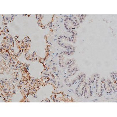 Phospho-Lyn (Tyr508) Antibody in Immunohistochemistry (Paraffin) (IHC (P))