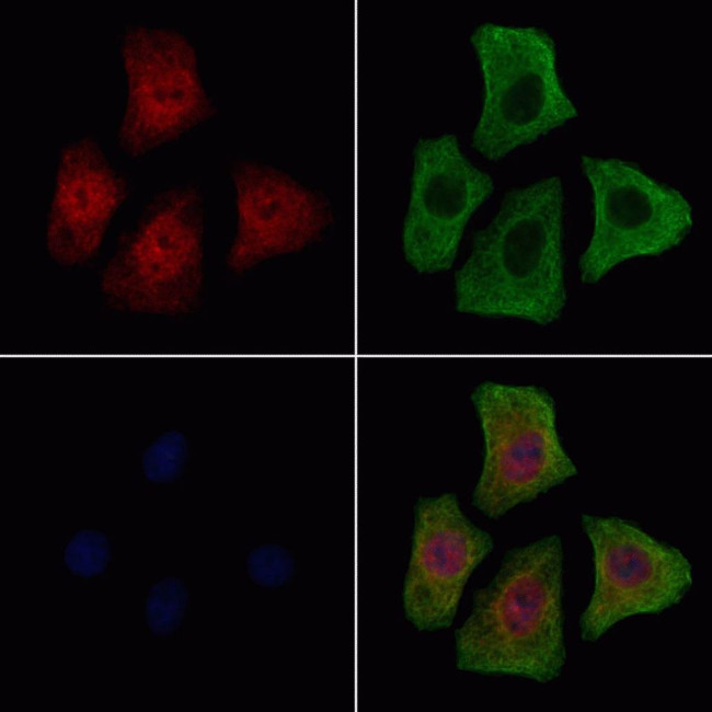 Phospho-FGFR1 (Tyr154) Antibody in Immunocytochemistry (ICC/IF)