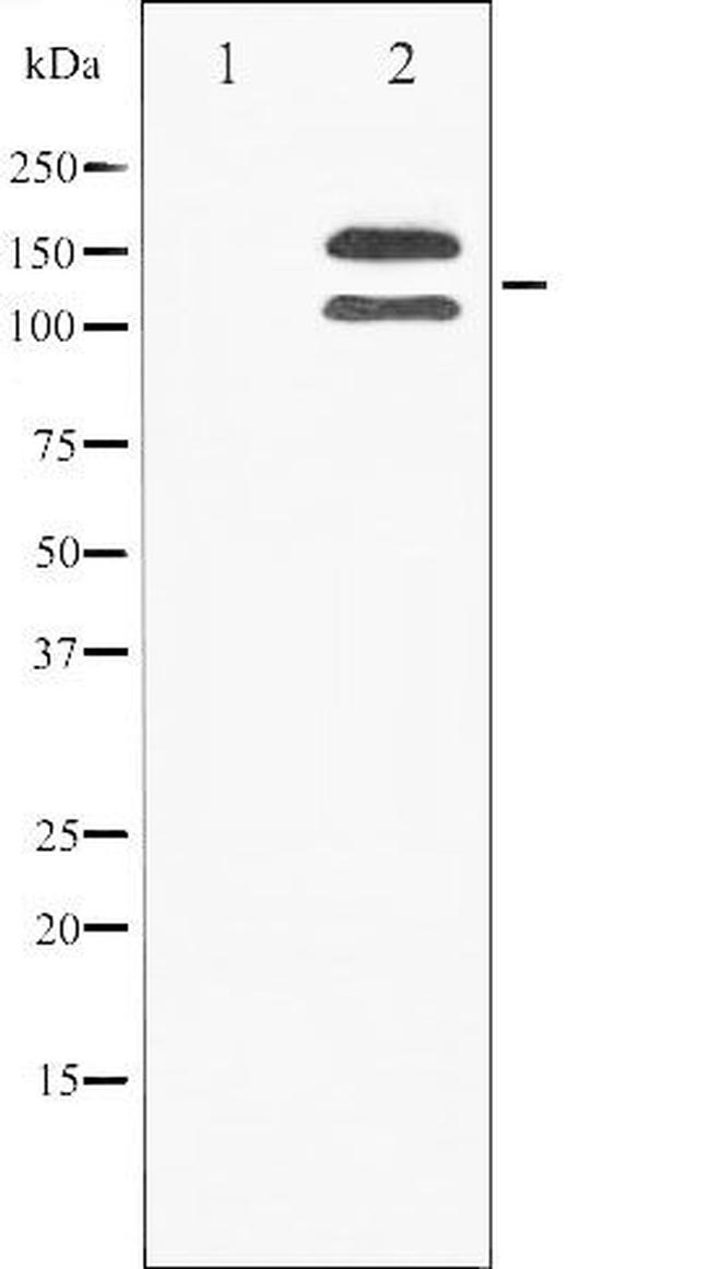 Phospho-FGFR1 (Tyr154) Antibody in Western Blot (WB)