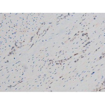 Phospho-GATA1 (Ser142) Antibody in Immunohistochemistry (Paraffin) (IHC (P))