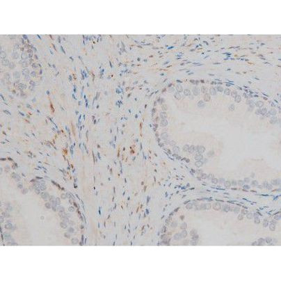 Phospho-GATA1 (Ser142) Antibody in Immunohistochemistry (Paraffin) (IHC (P))