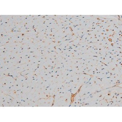 Phospho-GATA1 (Ser142) Antibody in Immunohistochemistry (Paraffin) (IHC (P))