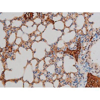 Phospho-GATA1 (Ser142) Antibody in Immunohistochemistry (Paraffin) (IHC (P))