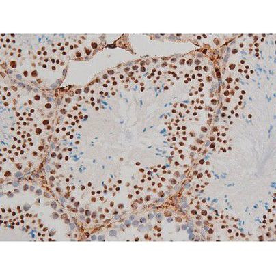 Phospho-GATA1 (Ser142) Antibody in Immunohistochemistry (Paraffin) (IHC (P))