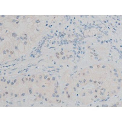 Phospho-GATA1 (Ser142) Antibody in Immunohistochemistry (Paraffin) (IHC (P))