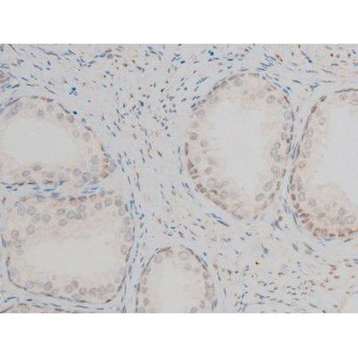 Phospho-GATA1 (Ser142) Antibody in Immunohistochemistry (Paraffin) (IHC (P))