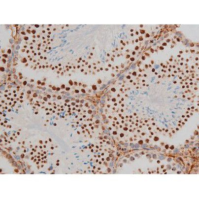 Phospho-GATA1 (Ser142) Antibody in Immunohistochemistry (Paraffin) (IHC (P))