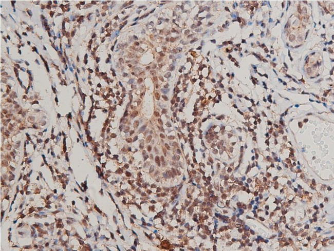 Phospho-VEGF Receptor 1 (Tyr1213) Antibody in Immunohistochemistry (Paraffin) (IHC (P))