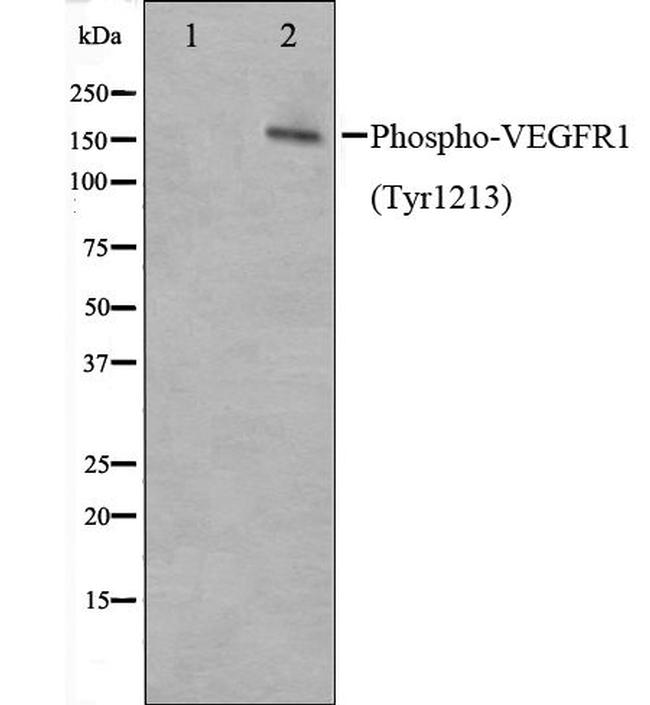 Phospho-VEGF Receptor 1 (Tyr1213) Antibody in Western Blot (WB)