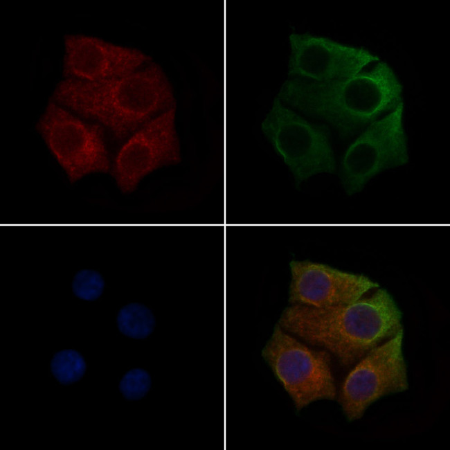 Phospho-VEGF Receptor 1 (Tyr1213) Antibody in Immunocytochemistry (ICC/IF)