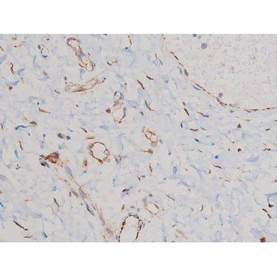 Phospho-Cdc25A (Ser124) Antibody in Immunohistochemistry (Paraffin) (IHC (P))