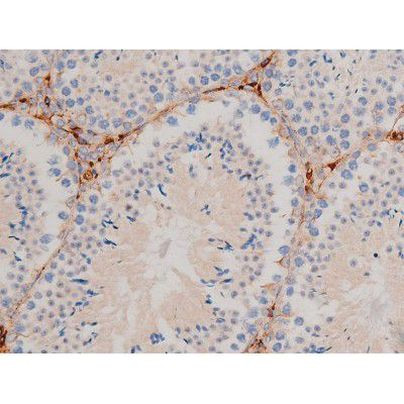 Phospho-Cdc25A (Ser124) Antibody in Immunohistochemistry (Paraffin) (IHC (P))