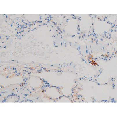 Phospho-Cdc25A (Ser124) Antibody in Immunohistochemistry (Paraffin) (IHC (P))