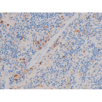 Phospho-Cdc25A (Ser124) Antibody in Immunohistochemistry (Paraffin) (IHC (P))