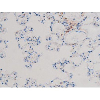 Phospho-Cdc25A (Ser124) Antibody in Immunohistochemistry (Paraffin) (IHC (P))