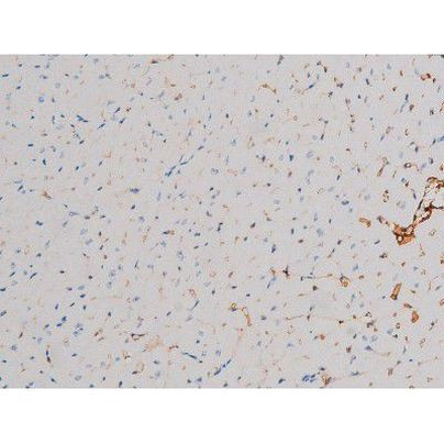 Phospho-CDC25A (Thr507) Antibody in Immunohistochemistry (Paraffin) (IHC (P))