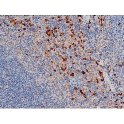 Phospho-CDC25A (Thr507) Antibody in Immunohistochemistry (Paraffin) (IHC (P))