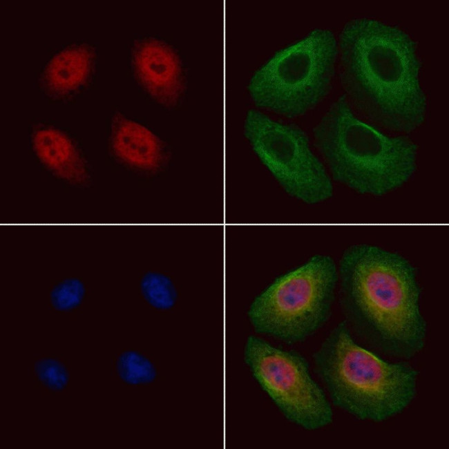 Phospho-SREBP1 (Ser439) Antibody in Immunocytochemistry (ICC/IF)